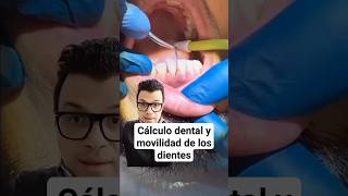 Encías INFLAMADAS Cálculo y Movilidad de los Dientes gingivitis odontologia [upl. by Ilek]