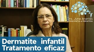 Eczema infantil  Tratamento [upl. by Herby]