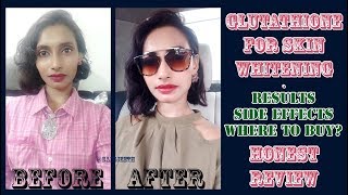 Glutathione Skin Whitening Tablets Results  Genuine Customer Review  SahiJeeth [upl. by Roach]