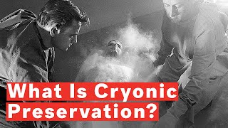 What Is Cryonic Preservation [upl. by Benia]