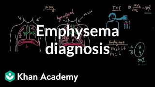 Emphysema diagnosis  Respiratory system diseases  NCLEXRN  Khan Academy [upl. by Civ700]