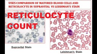 Reticulocyte Count  Supravital stain Comparison of Reticulocyte and Mature Red Blood Cell RBC [upl. by Serilda]