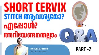 Short cervix  എപ്പോഴും stitch ആവശ്യമുണ്ടോ [upl. by Doowyah29]