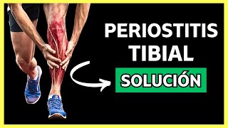 Guía Definitiva para CURAR la PERIOSTITIS TIBIAL Paso a Paso [upl. by Danyelle349]