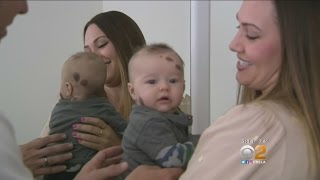 Couple Raising Awareness About Babys Rare Skin Disorder [upl. by Dej]