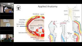 Truncal Blocks A new paradigm in Laparoscopic Donor Nephrectomy by Dr Tapas Kumar Singh SGPGIMS [upl. by Ehgit]