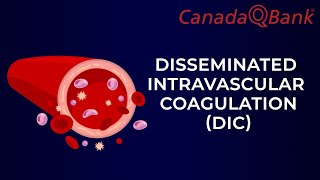 DIC Disseminated intravascular coagulation [upl. by Eenej]