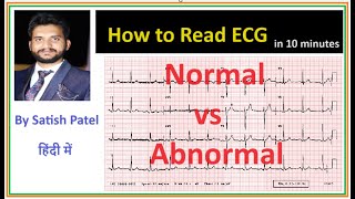 How to read an ECG normal vs abnormal ECGpna1 satishpatel [upl. by Elburt671]