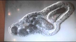 Amoeba eats two paramecia Amoebas lunch [upl. by Katti511]