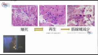 筋ジストロフィー臨床試験ネットワークが目指すもの [upl. by Eillom]