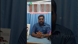 how to get rid of leg pain after workout  how to remove leg pain after running  lower leg pain [upl. by Hbaruas]