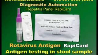 Rotavirus Antigen Rapid Test [upl. by Florencia703]