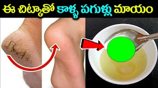 ఈ చిన్న చిట్కాతో కాళ్ళ పగుళ్లు మటుమాయం  Eliminate Cracked Heels and get White and Smooth Feet [upl. by Dredi]