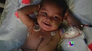 Un niño se recupera de un trasplante de cinco órganos en Miami  Noticiero Univisión [upl. by Teresa]