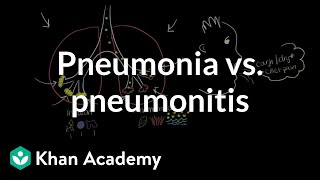 Pneumonia vs pneumonitis  Respiratory system diseases  NCLEXRN  Khan Academy [upl. by Kcirttap]