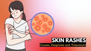 Skin Rash Causes Signs and Symptoms Diagnosis and Treatment [upl. by Arezzini]