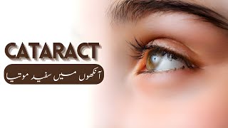 The Best Eye Drops for Cataract  Homeopathic Medicine  By Dr Ataullah [upl. by Atsirtal]