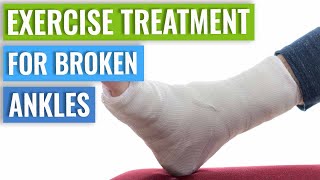 Ankle Fracture Treatment  Recovery Time amp Exercises [upl. by Aldercy]