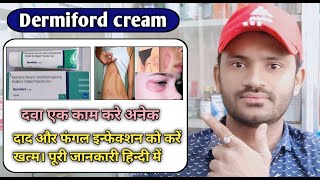 Dermiford cream use benefits and Side effects full review in hindi [upl. by Lorena]