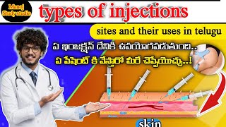 Types Of Injections Sites and Uses Common Injections and Their Uses manojstudystudio [upl. by Liemaj]