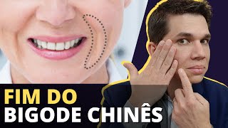 FIM DO BIGODE CHINÊS Como tratar e acabar DEFINITIVAMENTE com essa Ruga [upl. by Shel]