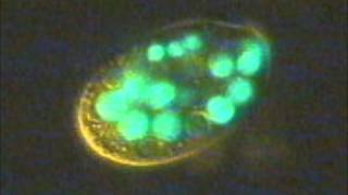 Ciliates eating fluorescent bacteria [upl. by Behn]