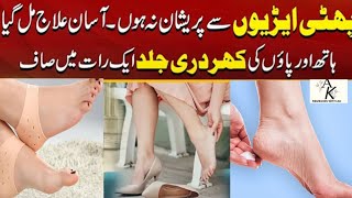 BEST Cracked heels cream How to Treat your Cracked heels At Home Amazing Formula [upl. by Otrebogad992]