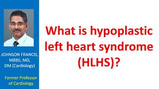 What is Hypoplastic Left Heart Syndrome [upl. by Keare]