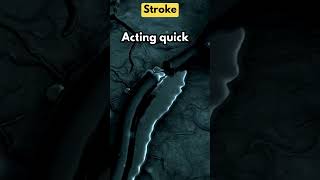 Signs Of A Stroke What You Need To Know [upl. by Kelson740]