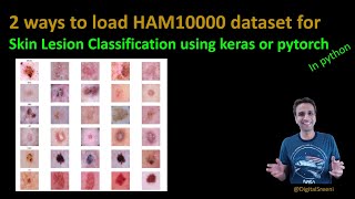 202  Two ways to read HAM10000 dataset into python for skin cancer lesion classification [upl. by Eiramlehcar856]