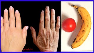 82 years grandma remove wrinkles from hands using banana Tighten skin on hands naturally forever [upl. by Annal]