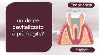 Endodonzia che cosè [upl. by Annocahs]