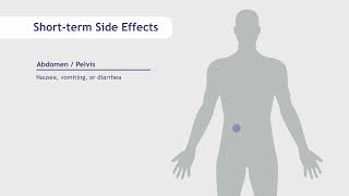 Side Effects of Radiation Therapy  SERO [upl. by Lanos]