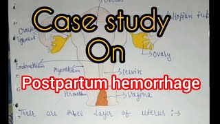 case study postpartum hemorrhage postpartum hemorrhage case study  obg care plan  medtalks [upl. by Thoma]