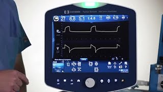 Puritan Bennett™ 980 Ventilator Basic Lesson Mode Setting Changes [upl. by Marthe]