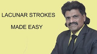 LACUNAR STROKES MADE EASY [upl. by Tanhya]