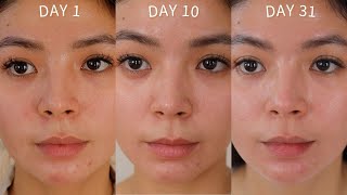 SKINCARE ROUTINE ZO SKIN HEALTH ONE MONTH RESULTS [upl. by Fara520]