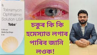 Toba Eye Drops Tobramycin Ophthalmic Solution USP [upl. by Orteip]