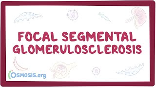 Focal Segmental Glomerulosclerosis  causes symptoms diagnosis treatment pathology [upl. by Delly]