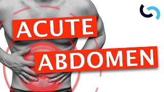 Acute Abdomen  Diagnosis and Management [upl. by Dewhurst]