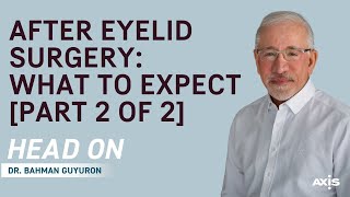 After Eyelid Surgery What to Expect Part 2 of 2 [upl. by Erret629]