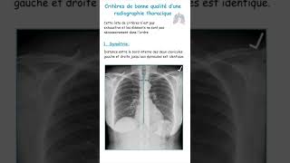 Critères De Bonne Qualité Dune Radiographie ThoraciquePneumologie shorts [upl. by Vigen]