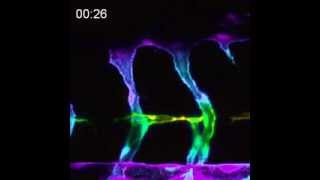 Endothelial cells in pten mutant zebrafish embryos form filopodia over time [upl. by Pompei]