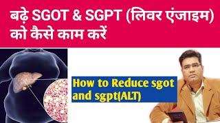 How to Reduce High SGOT and SGPT at home  Explained in Hindi  Raised Liver Enzyme Treatment [upl. by Leandra723]