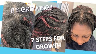 GROWING MY HAIR BACK FIGHTING ALOPECIA [upl. by Giardap643]