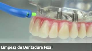 Limpeza de Dentadura Fixa [upl. by Ecnarual666]