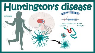 Huntingtons Disease  Pathology of Huntingtons Chorea  Diagnosis of Huntingtons disease [upl. by Beverley]