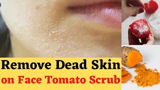 How to Remove Dead Skin From Face at Home  How to get rid of Dead Skin Cells on Body [upl. by Rafael]