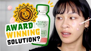 Honest Review 14 days WITH Mario Badescu Drying Lotion [upl. by Martinez]