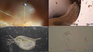 The Amazing Microscopic World [upl. by Ailegnave501]